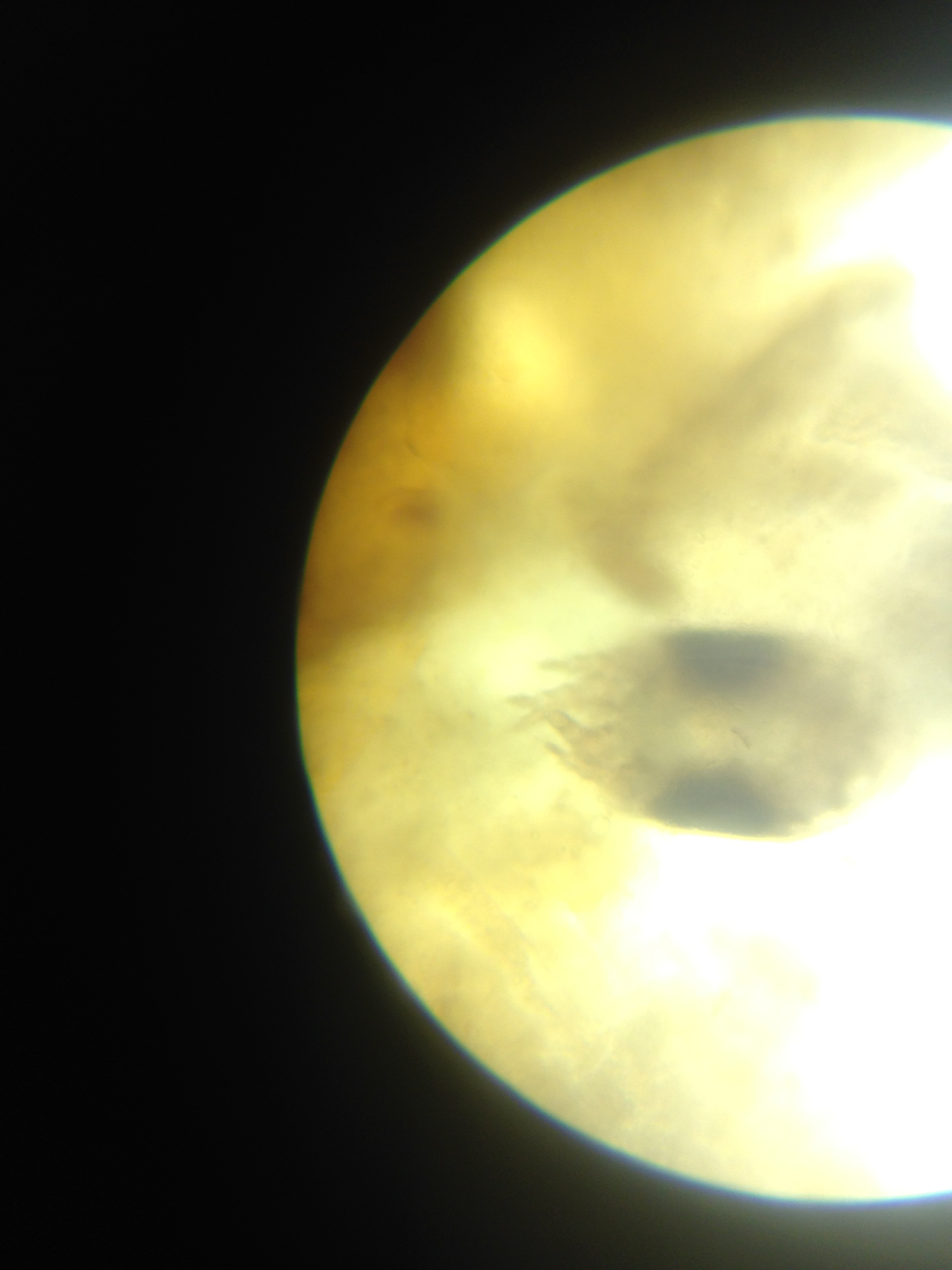 Mange mite under microscope